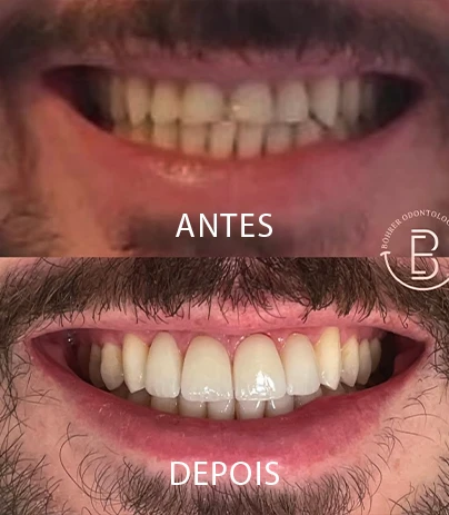 RES01