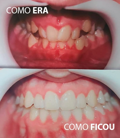 RES06-1