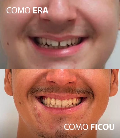 RESU08
