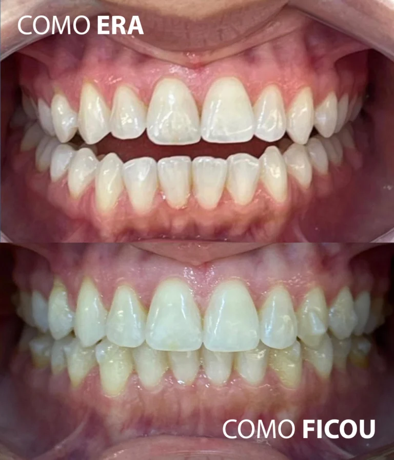 resu10-768x897